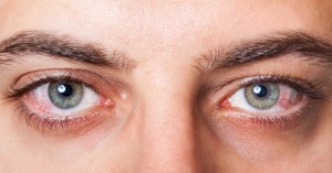 List of eye diseases and their symptoms